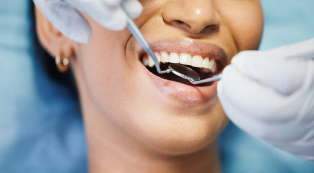 Best Emergency Dental Services for Seniors in Kerman, CA